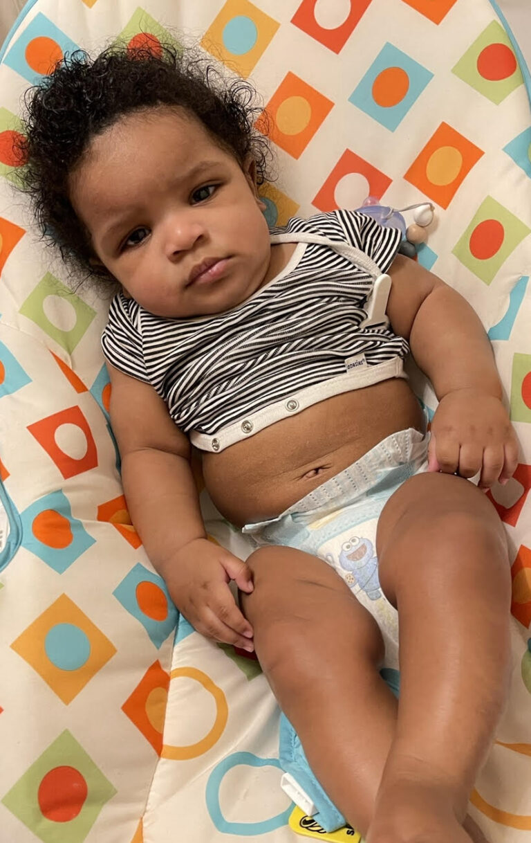 How to Fix Baby's Flat Head Without Helmet