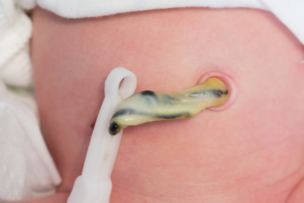 what are the benefits of delayed cord clamping for preterm babies