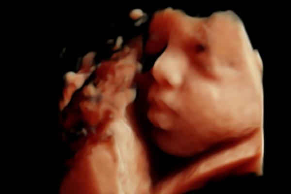 what is the importance of folic acid during pregnancy